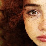 Как да се отървете от луничките? Как да се отървете от луничките?
