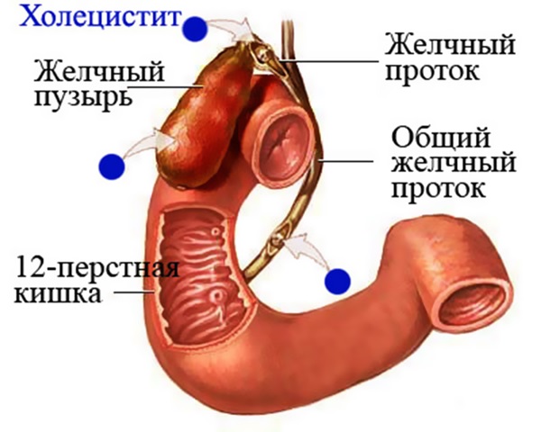 Болка в дясната страна на талията
