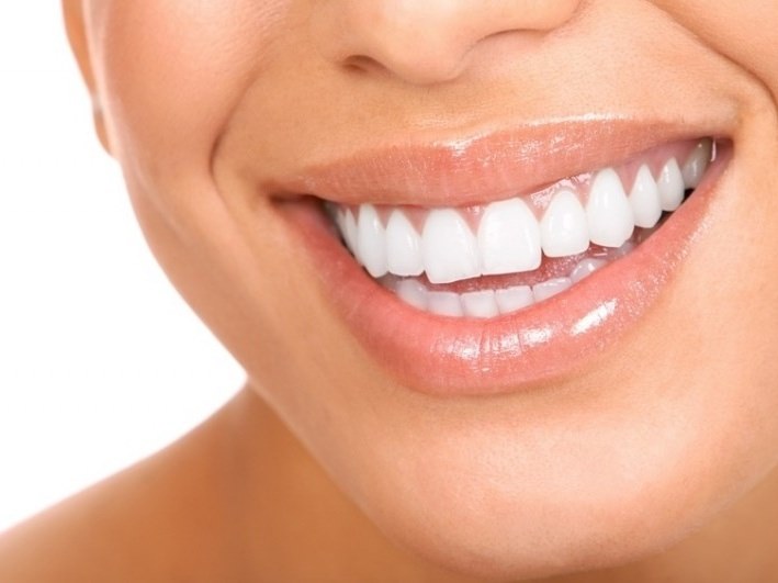 Възможно ли е да направите зъби дори без използването на скоби?