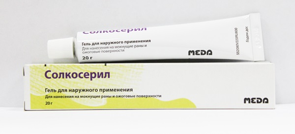 Изгаряне на кожата